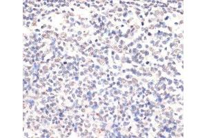 Immunohistochemistry of paraffin-embedded Human placenta using Phospho-Jak2(Y1007/1008) Polyclonal Antibody at dilution of 1:200 (40x lens). (JAK2 anticorps  (pTyr1007, pTyr1008))