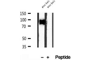Western blot analysis of extracts of mouse brain tissue, using SEC5/EXOC2 antibody.