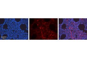 Rabbit Anti-HIF1A Antibody   Formalin Fixed Paraffin Embedded Tissue: Human Bone Marrow Tissue Observed Staining: Nucleus, Cytoplasm Primary Antibody Concentration: 1:100 Other Working Concentrations: N/A Secondary Antibody: Donkey anti-Rabbit-Cy3 Secondary Antibody Concentration: 1:200 Magnification: 20X Exposure Time: 0.