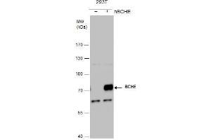 WB Image BCHE antibody detects BCHE protein by western blot analysis. (Butyrylcholinesterase anticorps)