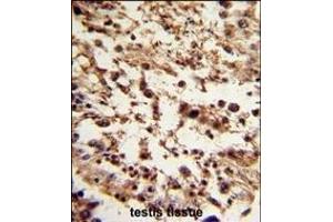 Formalin-fixed and paraffin-embedded human testis tissue reacted with TBP Antibody (C-term), which was peroxidase-conjugated to the secondary antibody, followed by DAB staining. (TBP anticorps  (C-Term))