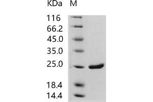 Western Blotting (WB) image for Human Immunodeficiency Virus 1 Capsid (HIV-1 p24) protein (His tag) (ABIN7196127)