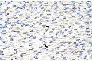 Rabbit Anti-EIF4B Antibody ,Paraffin Embedded Tissue: Human Heart  Cellular Data: Myocardial cells  Antibody Concentration: 4. (EIF4B anticorps  (C-Term))