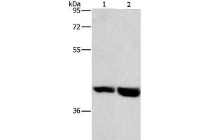 Western Blot analysis of Mouse heart and liver tissue using GPR182 Polyclonal Antibody at dilution of 1:1000 (G Protein-Coupled Receptor 182 anticorps)