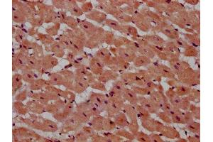 IHC image of ABIN7164923 diluted at 1:600 and staining in paraffin-embedded human heart tissue performed on a Leica BondTM system. (PSME4 anticorps  (AA 105-198))