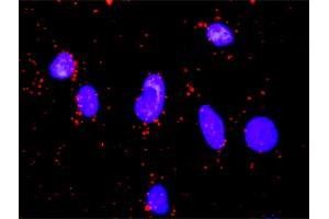 Proximity Ligation Analysis of protein-protein interactions between GSK3B and FOXO1. (FOXO1 anticorps  (AA 556-655))