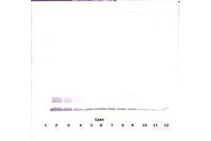 Image no. 3 for anti-Chemokine (C-C Motif) Ligand 8 (CCL8) antibody (ABIN465585) (CCL8 anticorps)