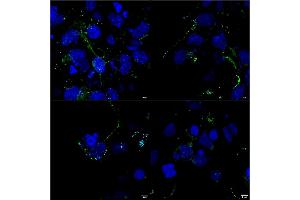 Immunocytochemistry/Immunofluorescence analysis using Mouse Anti-LRP4 Monoclonal Antibody, Clone S207-27 (ABIN2483388).