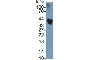 Detection of Hpt in Porcine Serum using Polyclonal Antibody to Haptoglobin (Hpt)