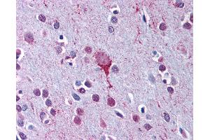 Anti-LPAR4 / GPR23 antibody IHC of human brain, cortex. (LPAR4 anticorps  (C-Term))