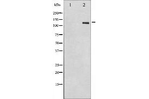 Western blot analysis of Integrin beta3 expression in HepG2 whole cell lysates,The lane on the left is treated with the antigen-specific peptide. (Integrin beta 3 anticorps  (C-Term))