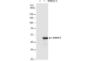 WB Image Ataxin 3 antibody detects Ataxin 3 protein by western blot analysis. (Ataxin 3 anticorps)