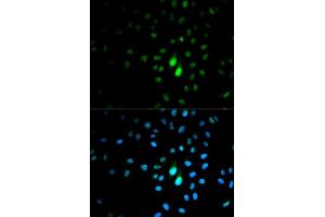 Immunofluorescence analysis of MCF-7 cells using PIN1 antibody. (PIN1 anticorps  (AA 1-163))