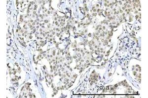 IHC analysis of RBM22 using anti-RBM22 antibody (ABIN7600268). (RBM22 anticorps  (AA 17-406))