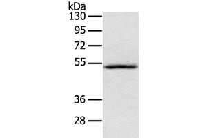 Western Blot analysis of Human normal liver tissue using IL17RB Polyclonal Antibody at dilution of 1:200 (IL17 Receptor B anticorps)