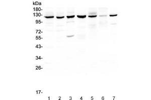 Western blot testing of PARP antibody and Lane 1:  COLO320