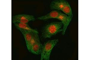 IF analysis of EZH1 using anti-EZH1 antibody (ABIN7601019) and anti-Tubulin Alpha antibody (ABIN7600339). (EZH1 anticorps  (AA 27-485))