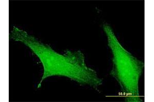 Immunofluorescence of purified MaxPab antibody to EFCAB4B on HeLa cell.