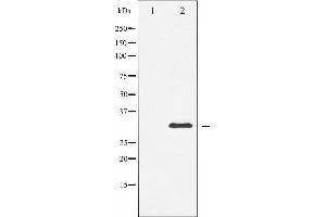 Western blot analysis of S6 Ribosomal Protein expression in serum treated 293 whole cell lysates,The lane on the left is treated with the antigen-specific peptide. (RPS6 anticorps  (C-Term))