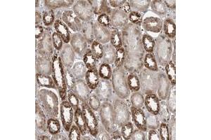 Immunohistochemical staining of human kidney with C17orf70 polyclonal antibody  shows strong cytoplasmic positivity in proximal tubules at 1:50-1:200 dilution. (C17orf70 anticorps)