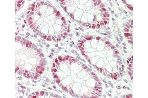 Formalin-fixed and paraffin-embedded H.