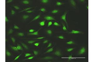 Immunofluorescence of purified MaxPab antibody to FANCC on HeLa cell. (FANCC anticorps  (AA 1-558))