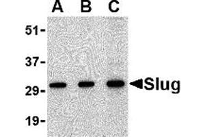 Western Blotting (WB) image for anti-SLUG (Middle Region 2) antibody (ABIN1031203) (SLUG anticorps  (Middle Region 2))
