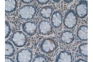 Detection of LPCAT3 in Human Rectum Tissue using Polyclonal Antibody to Lysophosphatidylcholine Acyltransferase 3 (LPCAT3)