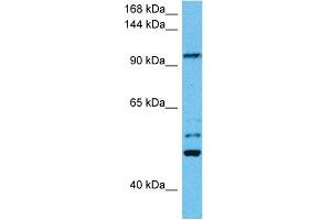 Host:  Mouse  Target Name:  KIF23  Sample Tissue:  Mouse Testis  Antibody Dilution:  1ug/ml (KIF23 anticorps  (N-Term))