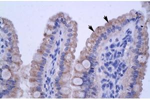 Human Intestine (ZNF358 anticorps  (N-Term))
