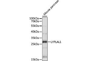 Western blot analysis of extracts of Mouse pancreas, using LYPL antibody (ABIN7268340) at 1:1000 dilution. (LYPLAL1 anticorps  (AA 1-100))