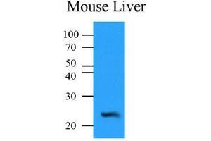 Mouse liver lysates (35 ug) were resolved by SDS-PAGE, transferred to PVDF membrane and probed with anti-human NQO2 (1:500). (NQO2 anticorps  (AA 1-231))