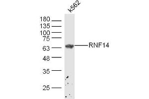 K562 lysates probed with ADAM2 Polyclonal Antibody, Unconjugated  at 1:300 dilution and 4˚C overnight incubation. (ADAM2 anticorps  (AA 451-550))