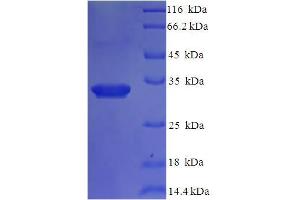 SDS-PAGE (SDS) image for Interleukin 1 delta (FIL1d) (AA 1-155), (full length) protein (His-SUMO Tag) (ABIN5711795) (FIL1d Protein (AA 1-155, full length) (His-SUMO Tag))