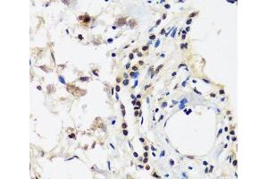 Immunohistochemistry of paraffin-embedded Human lung using CAND1 Polyclonal Antibody at dilution of 1:100 (40x lens). (CAND1 anticorps)