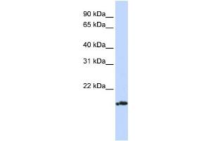 WB Suggested Anti-PLDN Antibody Titration: 0. (Pallidin anticorps  (Middle Region))