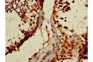 Immunohistochemistry of paraffin-embedded human testis tissue using ABIN7164194 at dilution of 1:100 (WTAP anticorps  (AA 1-151))