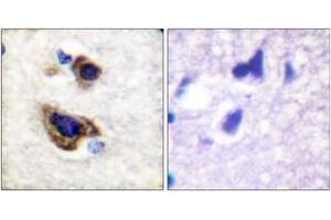 Immunohistochemistry analysis of paraffin-embedded human brain tissue, using GFAP (Ab-38) Antibody. (GFAP anticorps  (AA 11-60))