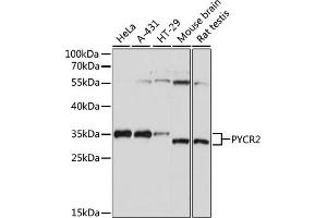 Western blot analysis of extracts of various cell lines, using PYCR2 antibody (ABIN7269766) at 1:1000 dilution. (PYCR2 anticorps  (AA 271-320))