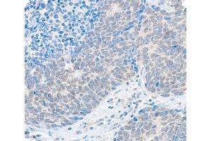 Immunohistochemistry (IHC) image for anti-Ubiquitin Specific Peptidase 37 (USP37) (C-Term) antibody (ABIN7453891)