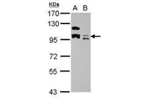 Image no. 3 for anti-Potassium Channel Tetramerisation Domain Containing 19 (KCTD19) (AA 1-162) antibody (ABIN1501897) (KCTD19 anticorps  (AA 1-162))