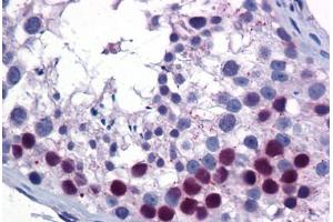 Human Testis: Formalin-Fixed, Paraffin-Embedded (FFPE) (SIRT6 anticorps  (AA 56-105))