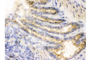 IHC analysis of COMT using anti-COMT antibody .