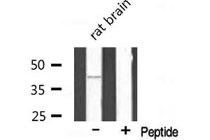Western blot analysis of extracts from rat brain, using DUSP9 antibody.