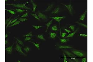 Immunofluorescence of purified MaxPab antibody to ARAF on HeLa cell.