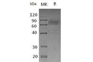Western Blotting (WB) image for TYRO3 Protein Tyrosine Kinase (TYRO3) protein (mFc Tag) (ABIN7320680)