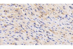 Detection of ALB in Human Cardiac Muscle Tissue using Polyclonal Antibody to Albumin (ALB) (Albumin anticorps)