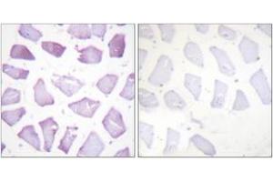 Immunohistochemistry analysis of paraffin-embedded human skeletal muscle, using PEA-15 (Phospho-Ser116) Antibody. (PEA15 anticorps  (pSer116))