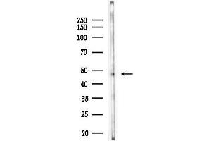 Western blot analysis of lysates from COLO205 cells, using KY Antibody at 1/1000 dilution.