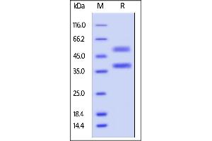 Human ANGPTL7, His Tag on  under reducing (R) condition. (ANGPTL7 Protein (AA 27-346) (His tag))